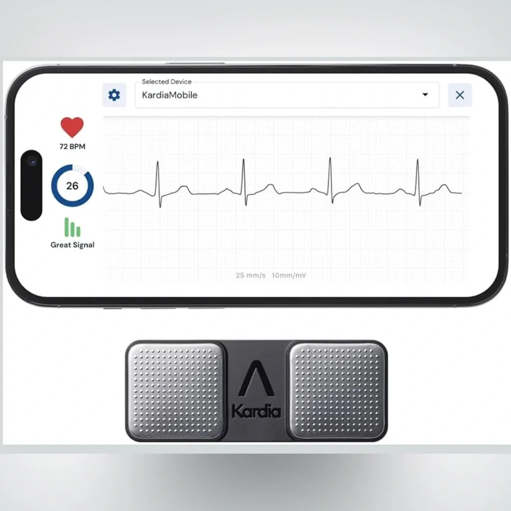 Alivecor ekg go